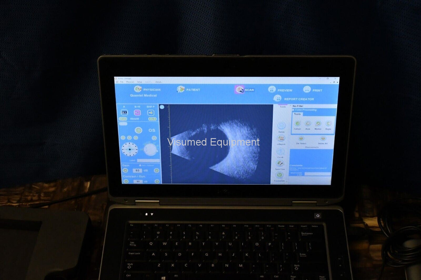 Refurbished Quantel Medical Aviso B scan Ultrasound complete offered by Visumed Equipment