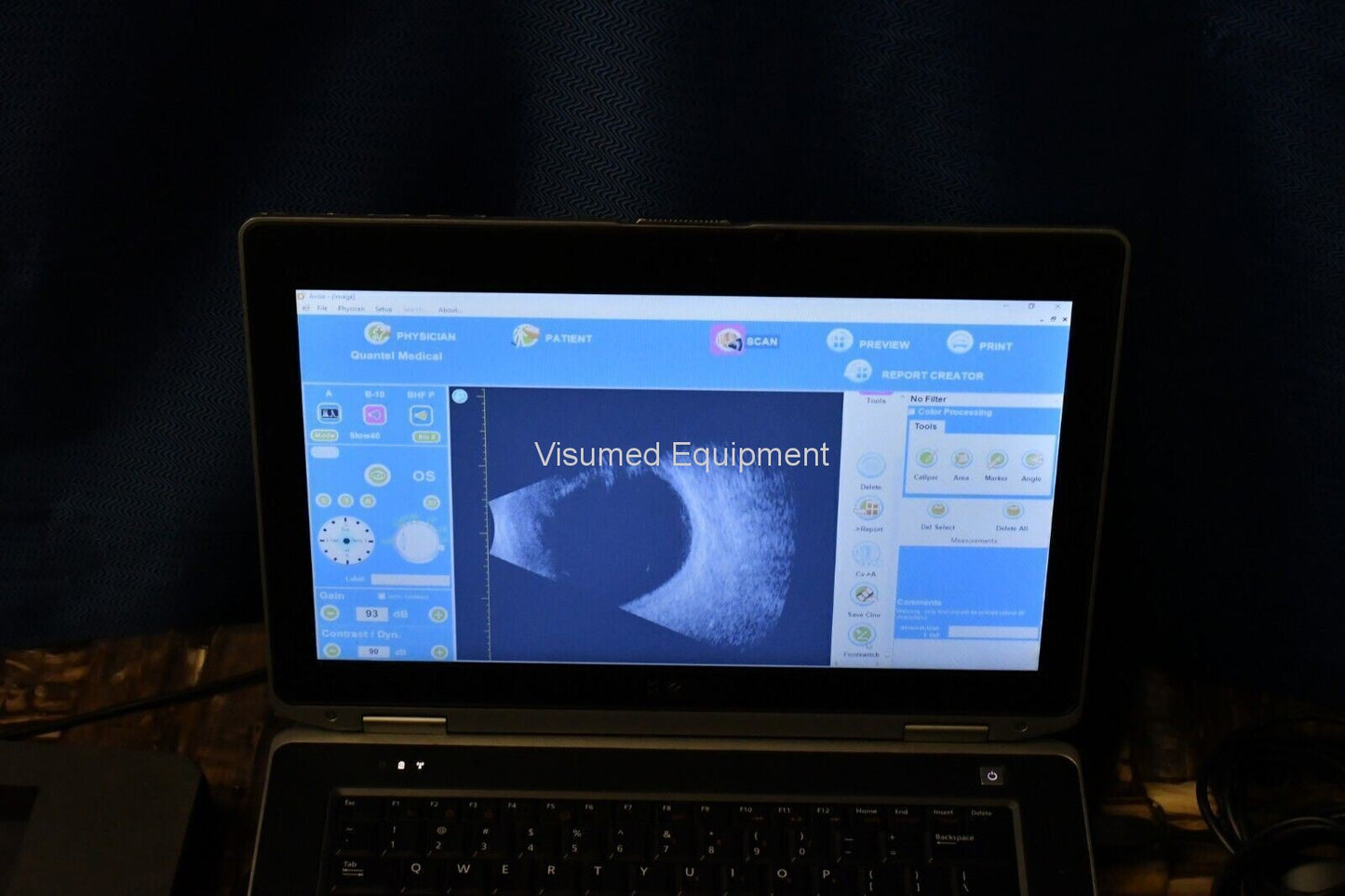Refurbished Quantel Medical Aviso B scan Ultrasound complete offered by Visumed Equipment