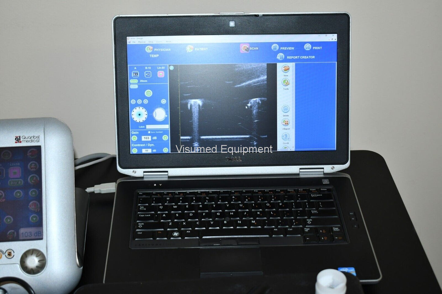 Refurbished Quantel Aviso UBM ophthalmic ultrasound offered by Visumed Equipment