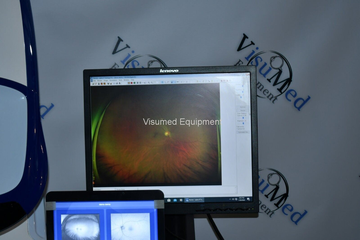Refurbished Optos Daytona RG AF retinal Camera offered by Visumed Equipment