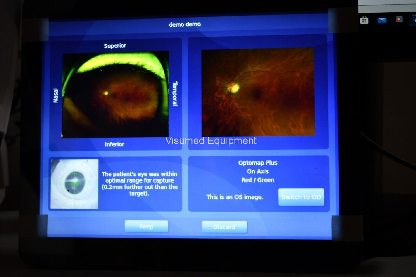 Refurbished Optos Daytona RG AF retinal Camera offered by Visumed Equipment