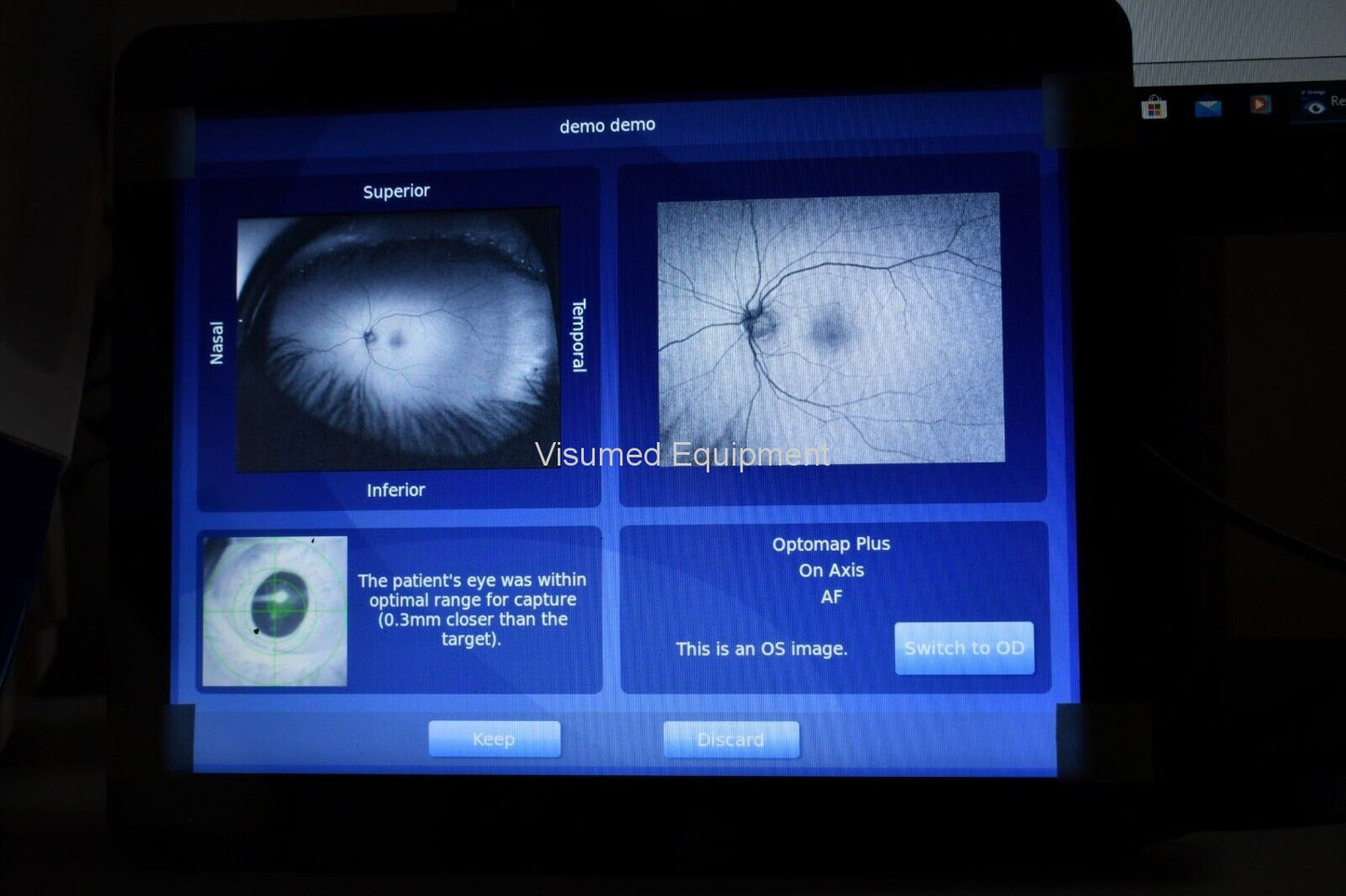 Refurbished Optos Daytona RG AF retinal Camera offered by Visumed Equipment