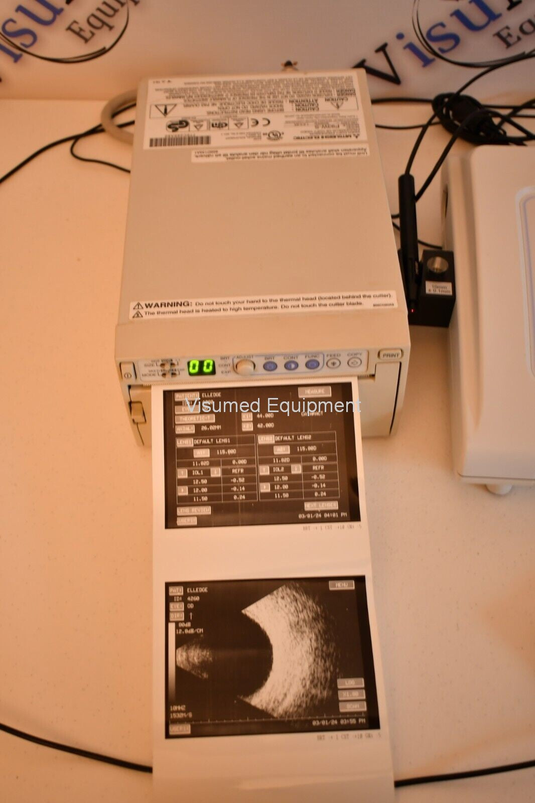 Refurbished Sonomed AB-5500 EZ Bscan A-scan B-scan Ophthalmic ultrasound with Printer offered by Visumed Equipment