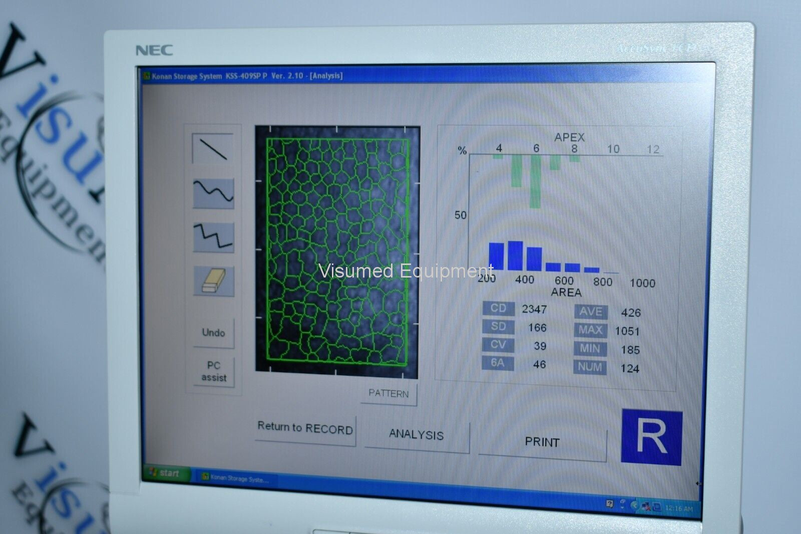 Refurbished Konan Specular microscope offered by Visumed Equipment