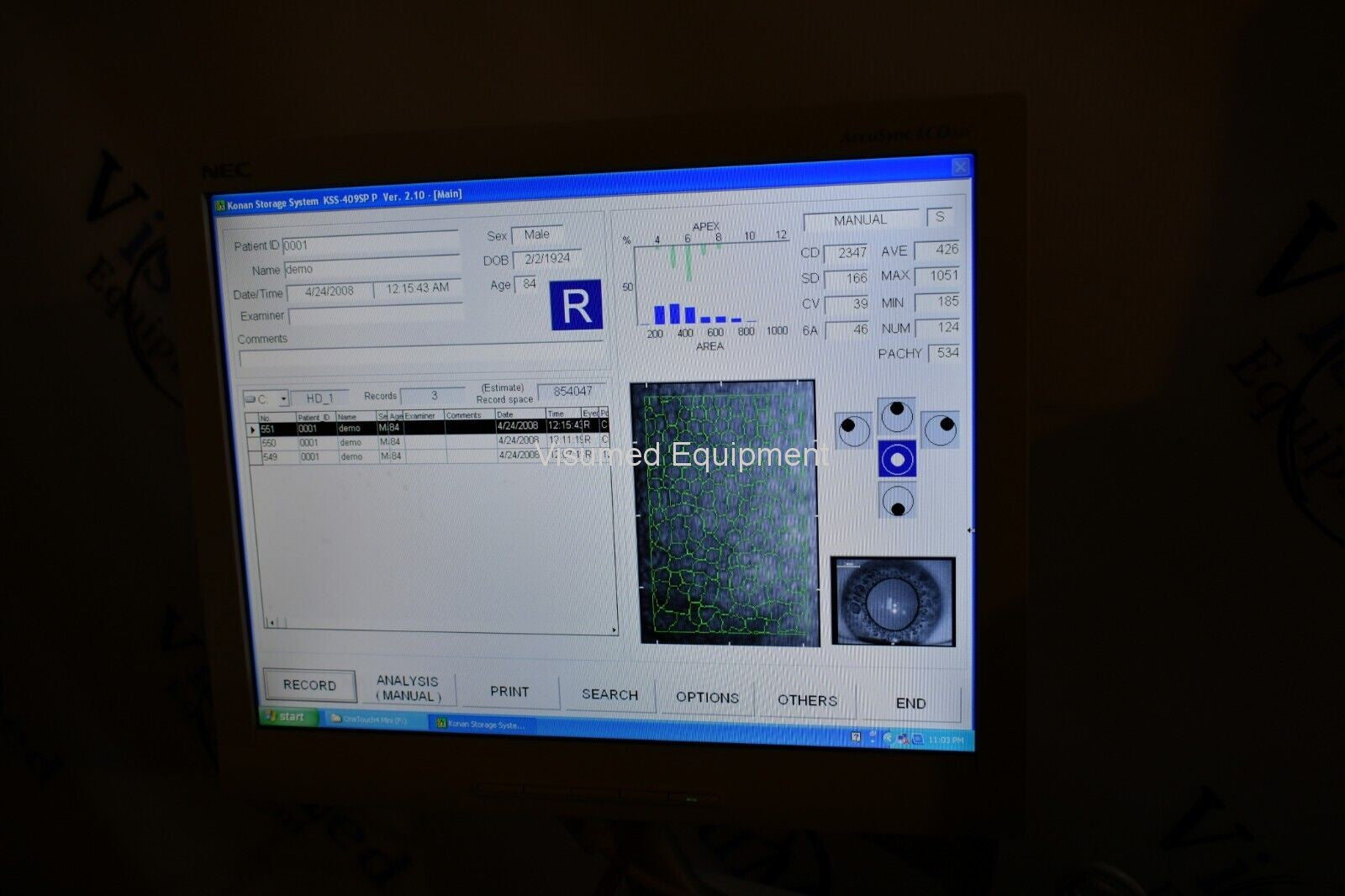 Refurbished Konan Specular microscope offered by Visumed Equipment