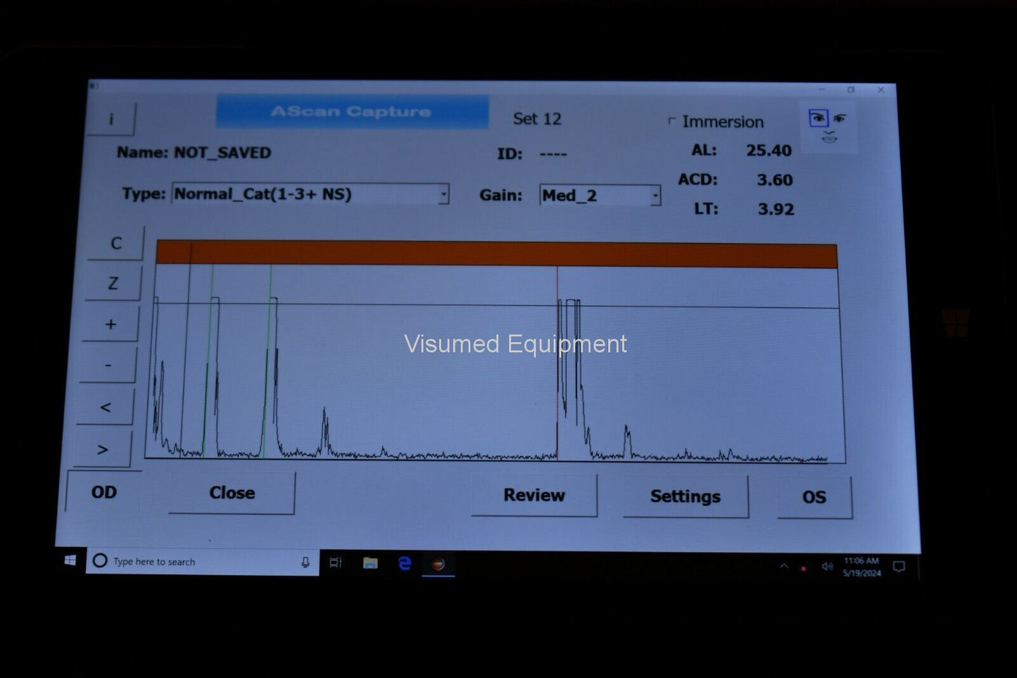 Refurbished MicroMedical Device MMD portable Ascan utrasonic biometer offered by Visumed Equipment