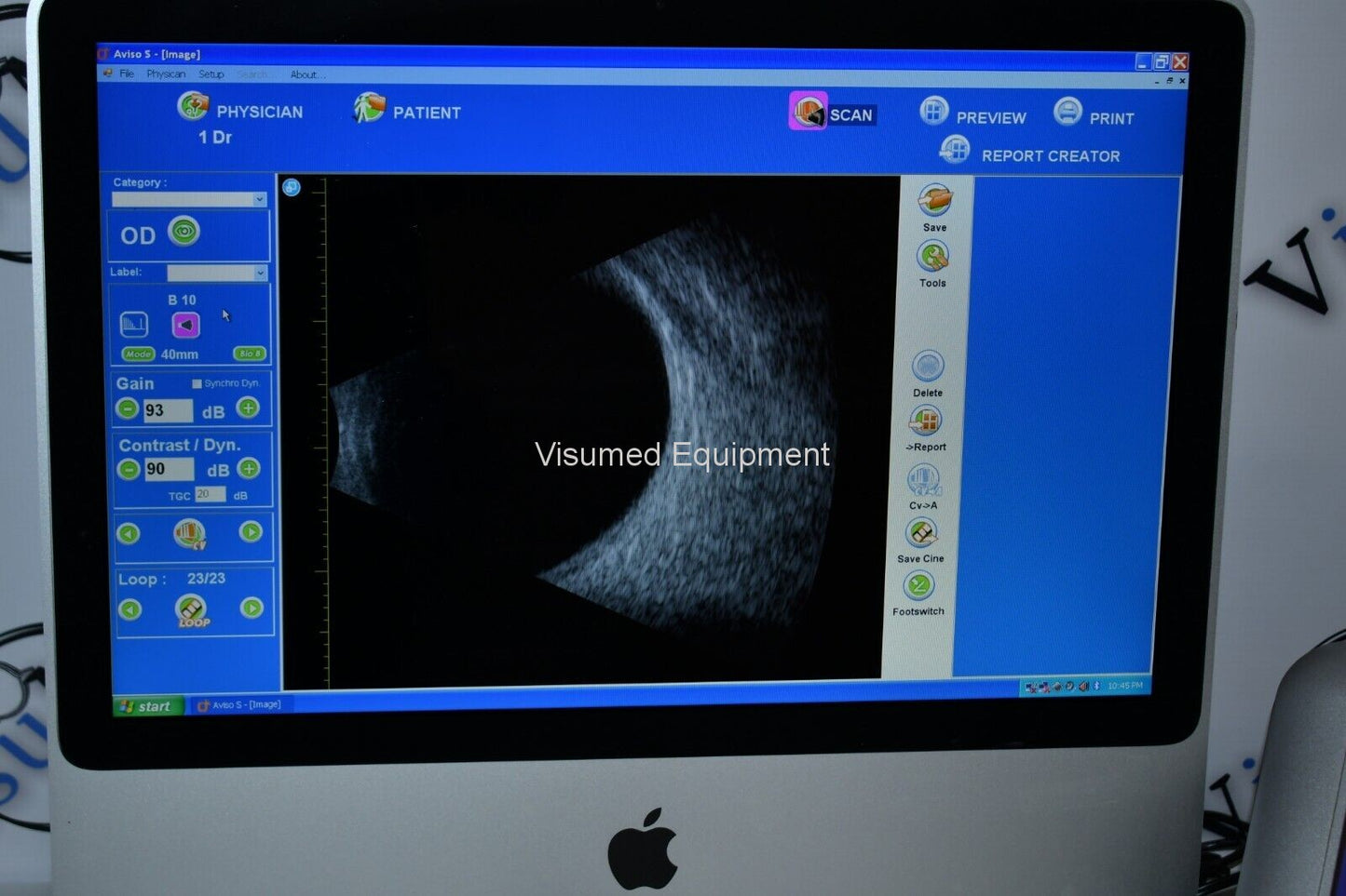 Refurbished Quantel Aviso S Diagnostic Ascan and Bscan Ophthalmic ultrasound offered by Visumed Equipment