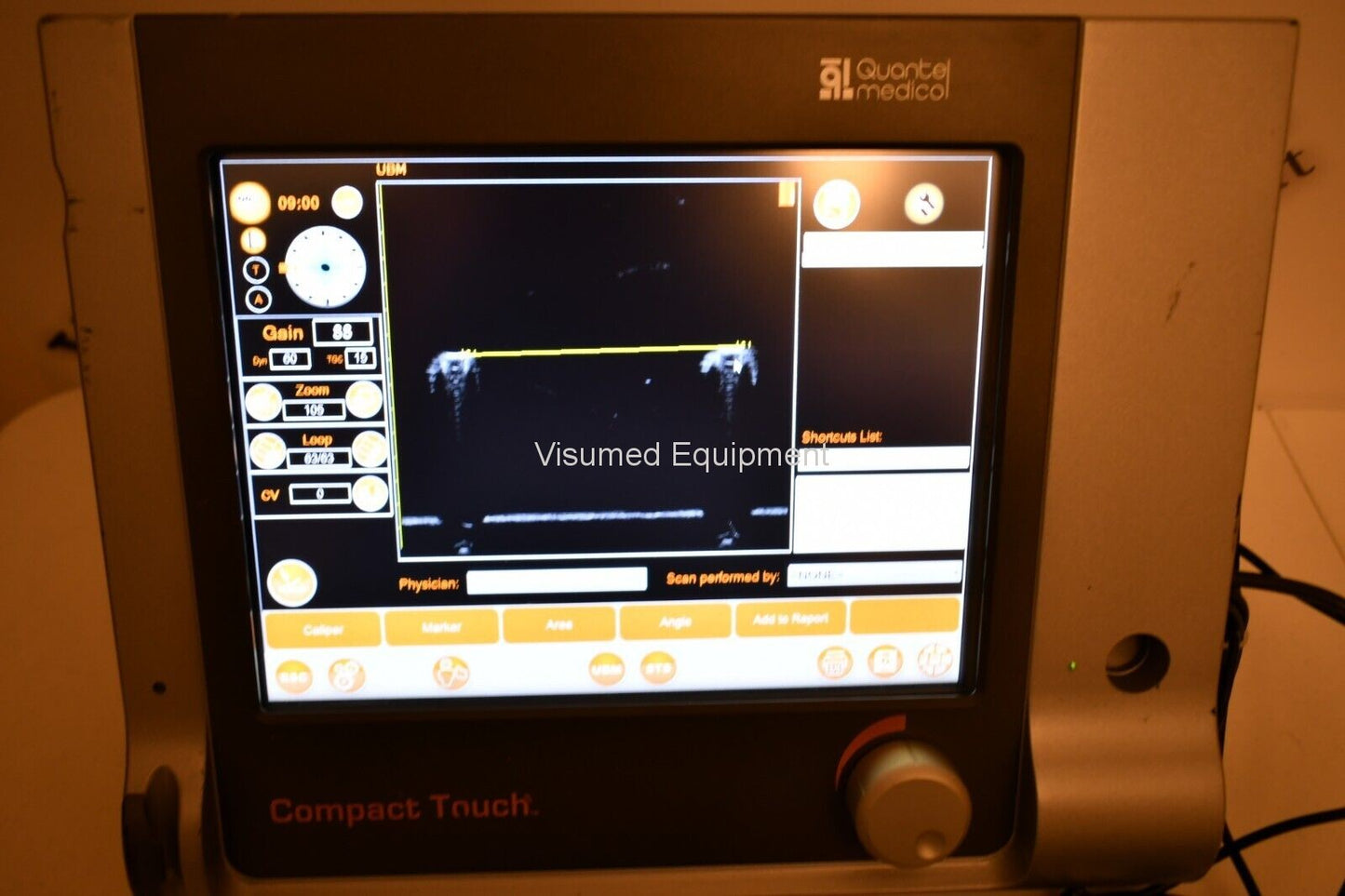 Refurbished Quantel compact touch STS UBM Ophthalmic ultrasound offered by Visumed Equipment