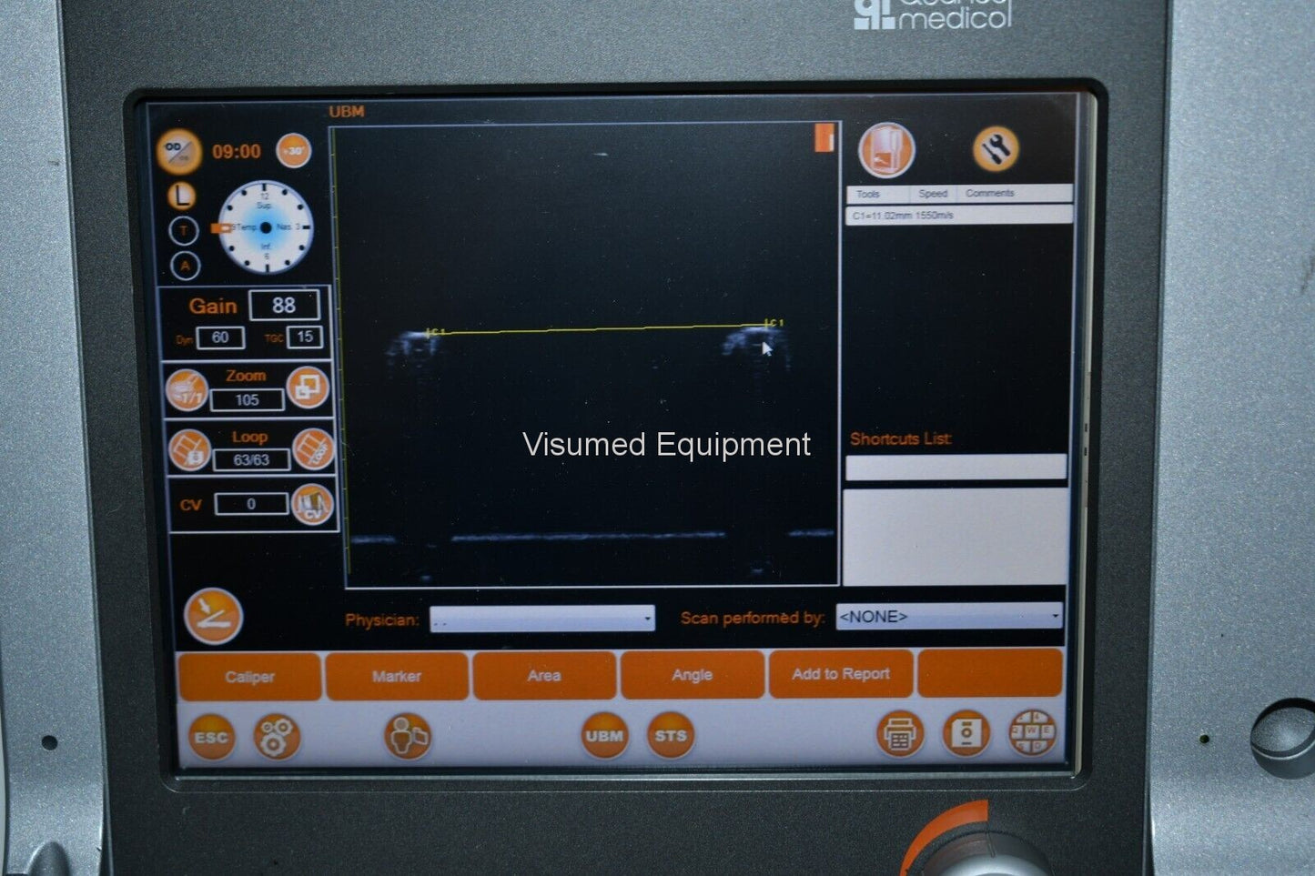 Refurbished Quantel compact touch STS UBM Ophthalmic ultrasound offered by Visumed Equipment