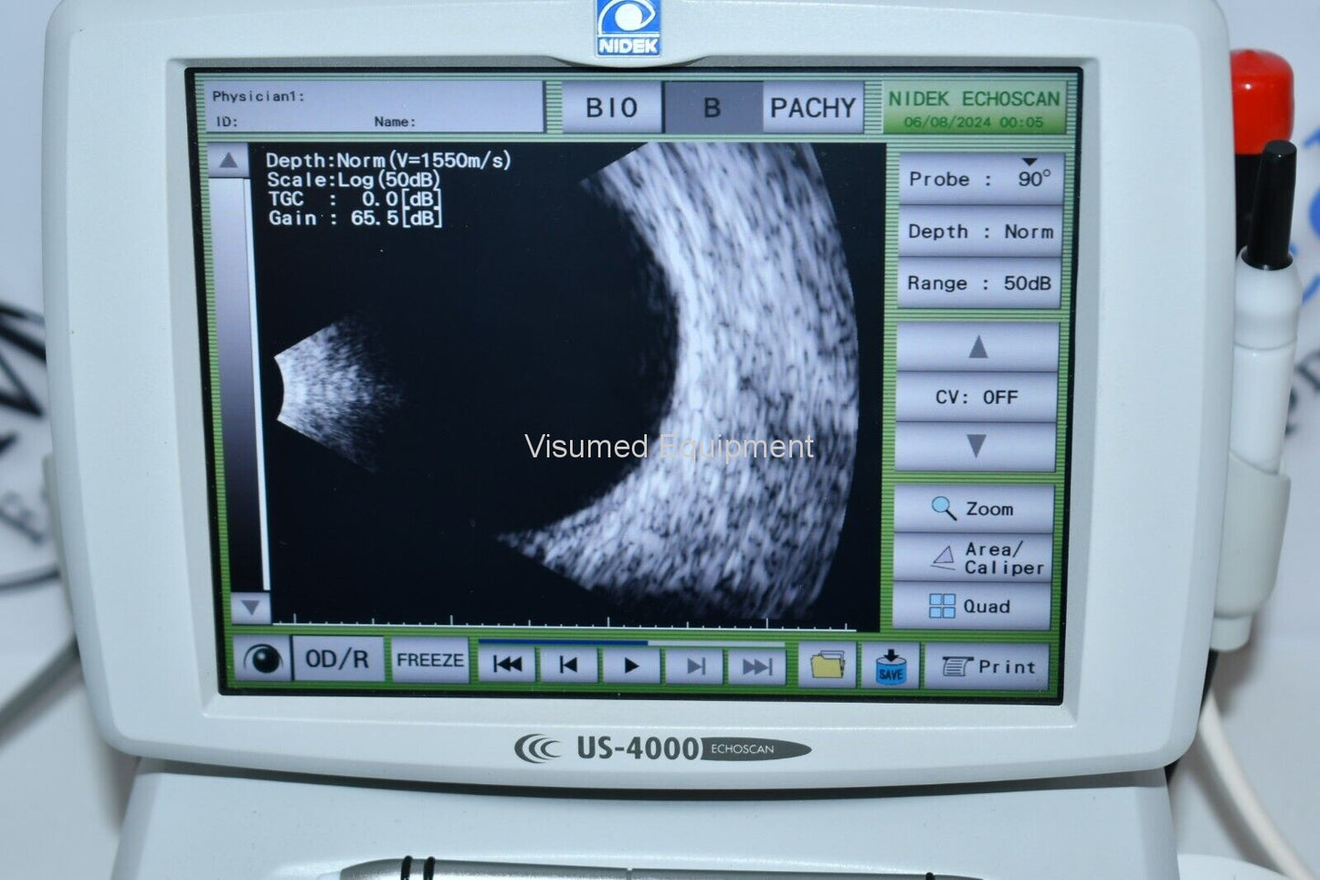 Refurbished Nidek Echoscan US-4000 A scan Bscan Pachymeter ophthalmic ultrasound offered by Visumed Equipment