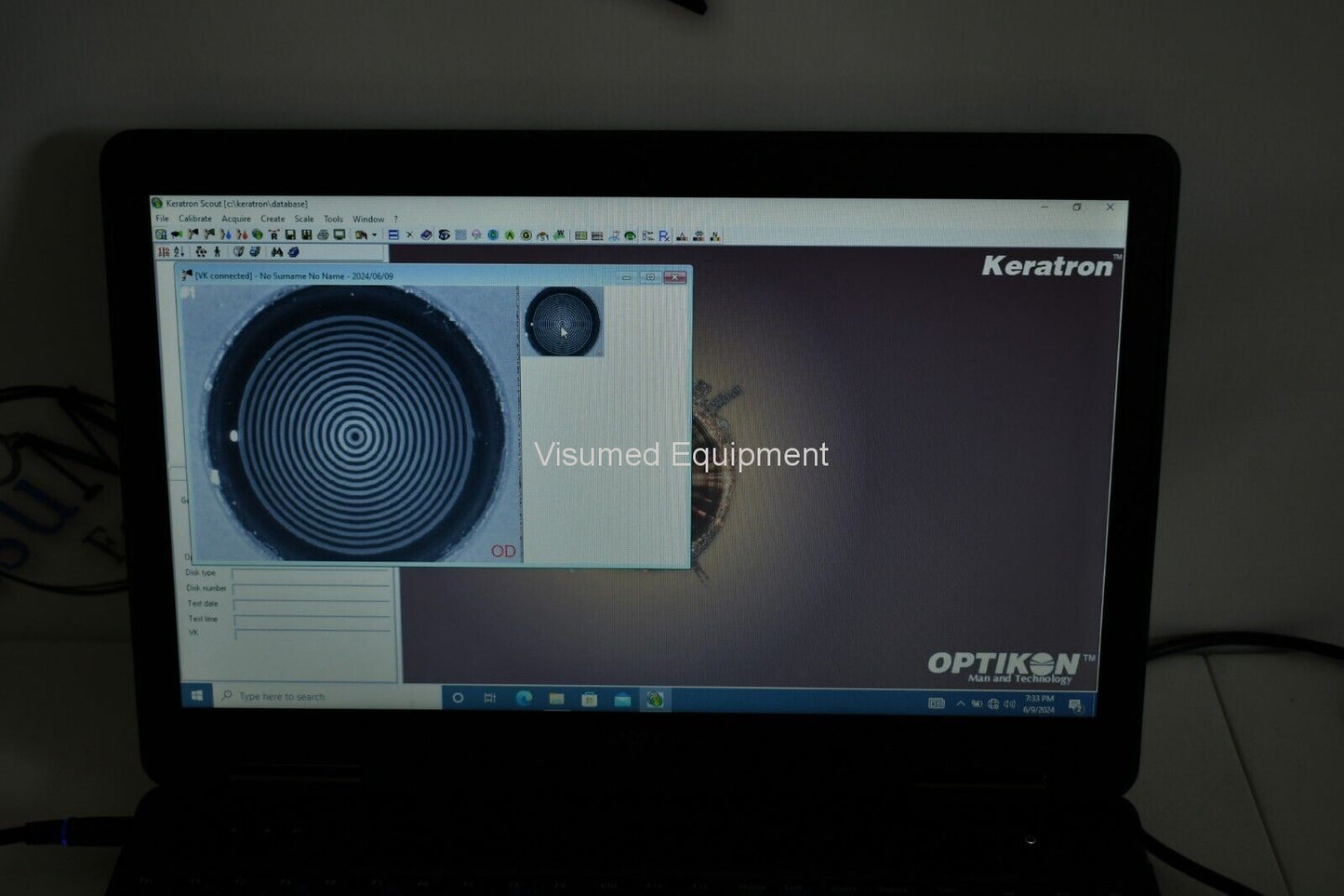 Refurbished Optikon Keratron scout 2000 USB portable Topographer with new battery offered by Visumed Equipment