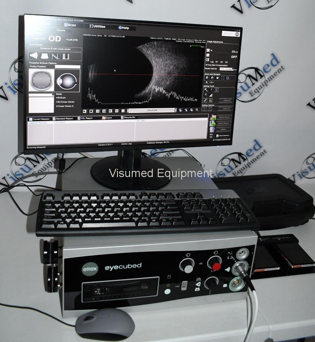 Refurbished Ellex Eyecubed V4 Ophthalmic Ultrasound System With B-scan probe offered by Visumed Equipment