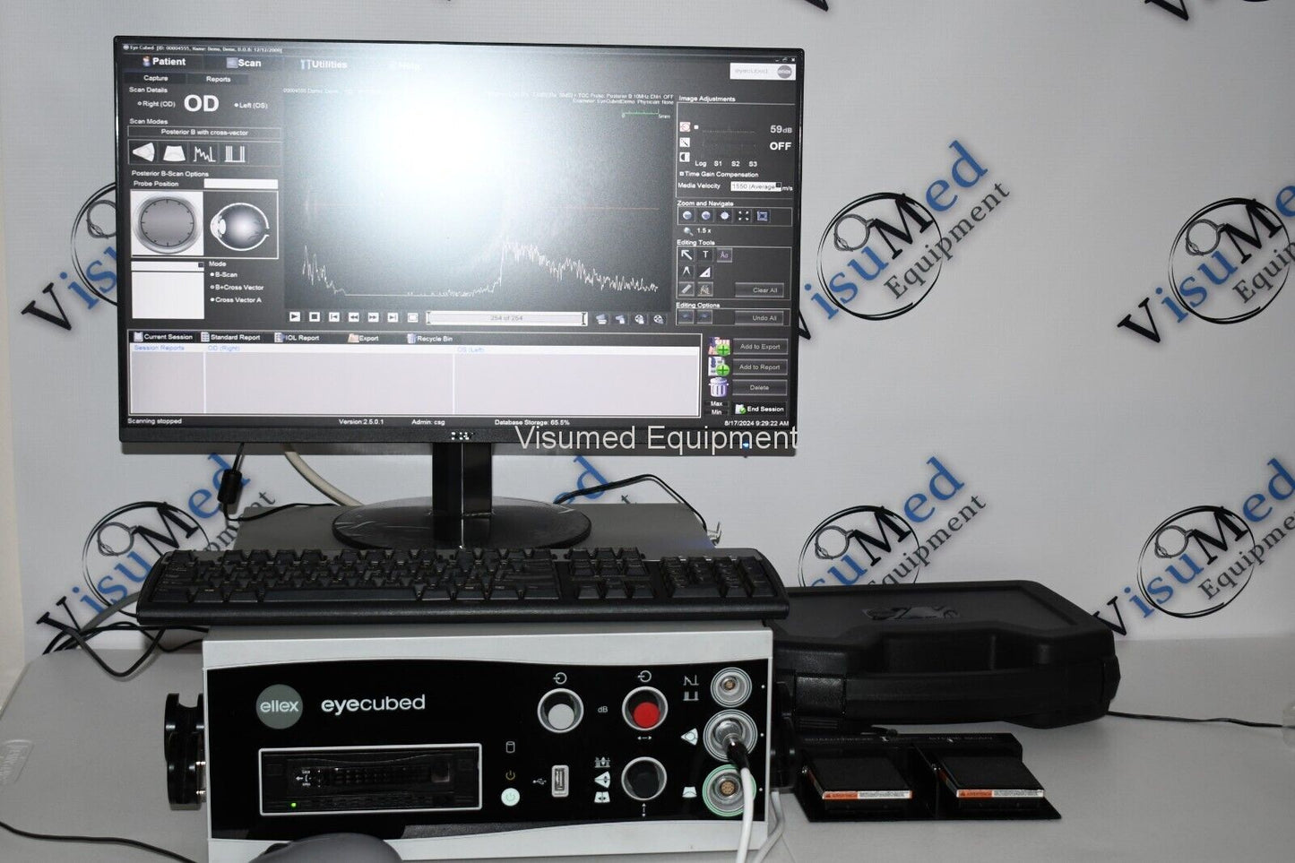 Refurbished Ellex Eyecubed V4 Ophthalmic Ultrasound System With B-scan probe offered by Visumed Equipment