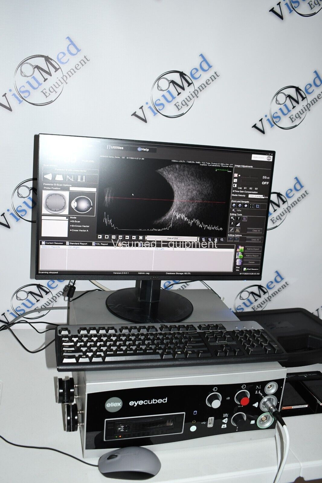 Refurbished Ellex Eyecubed V4 Ophthalmic Ultrasound System With B-scan probe offered by Visumed Equipment