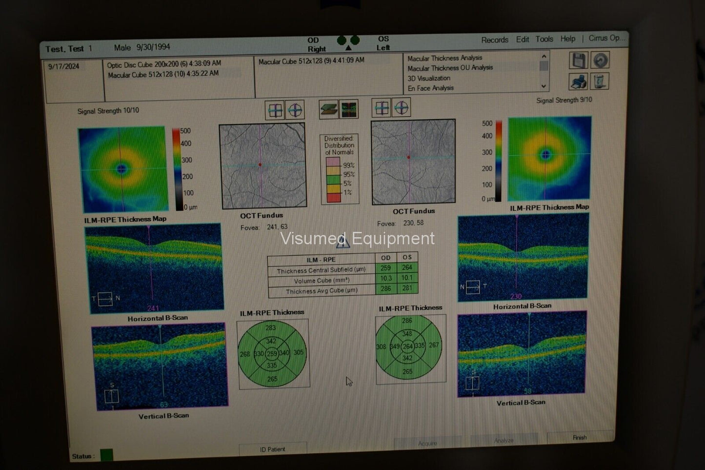 Refurbished Zeiss Cirrus 4000 Windows 10 - Fully Refurbished offered by Visumed Equipment