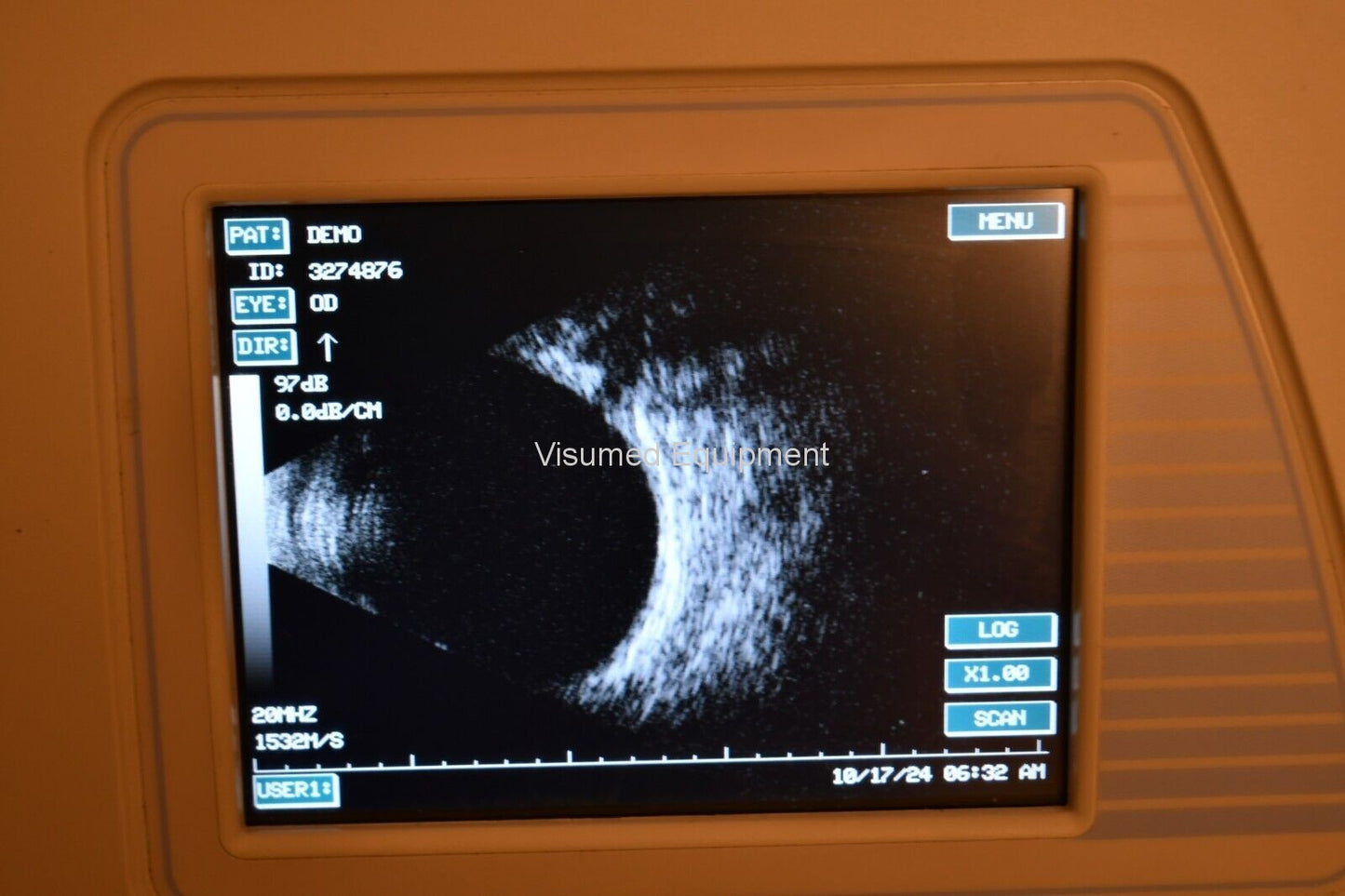 Refurbished Sonomed AB 5500-EZ A-scan B-scan with Printer offered by Visumed Equipment