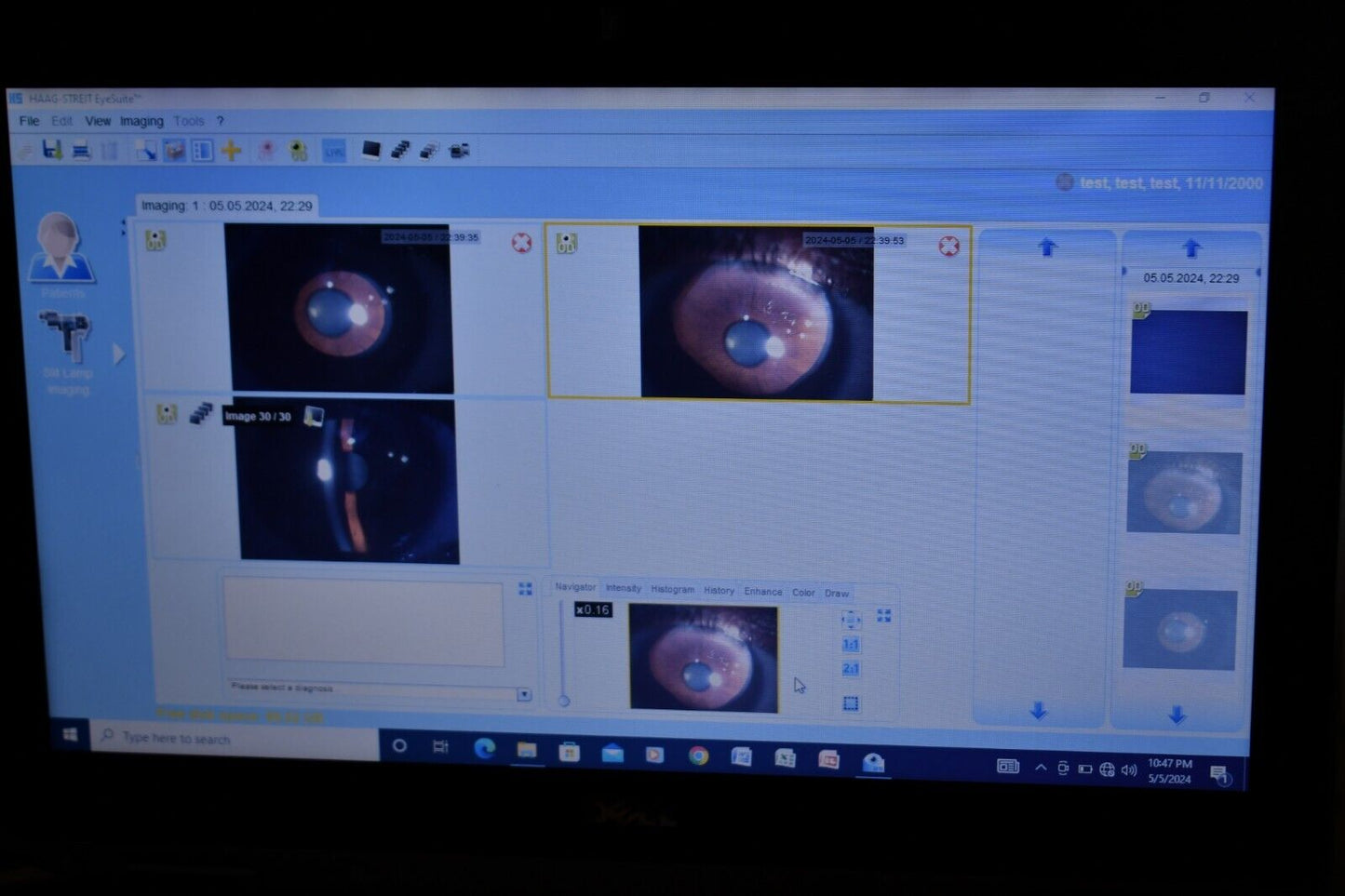 Refurbished Haag Streit BQ 900 Slit Lamp w/ IM 900 Imaging System, manual Table offered by Visumed Equipment