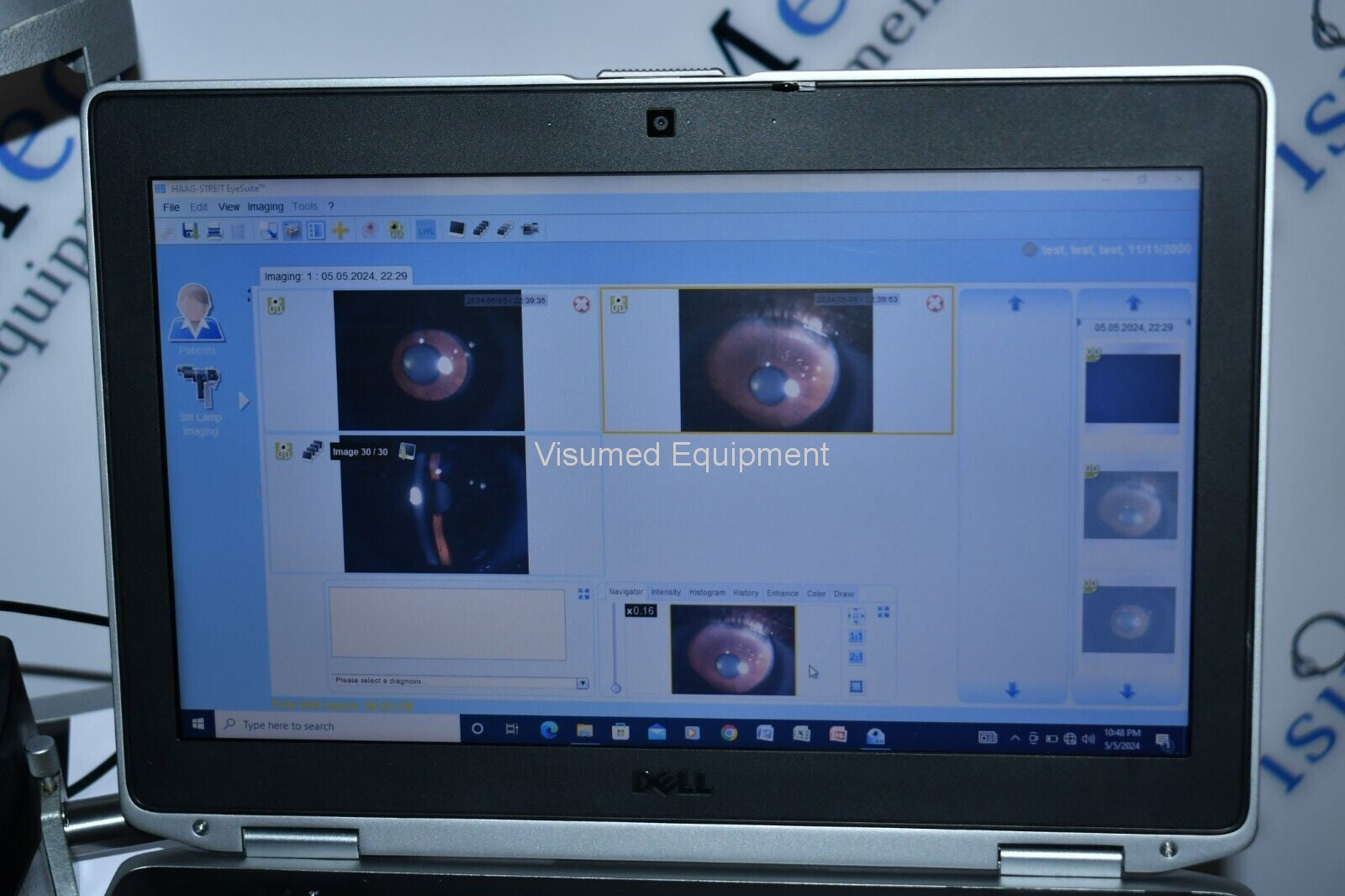 Refurbished Haag Streit BQ 900 Slit Lamp w/ IM 900 Imaging System, manual Table offered by Visumed Equipment