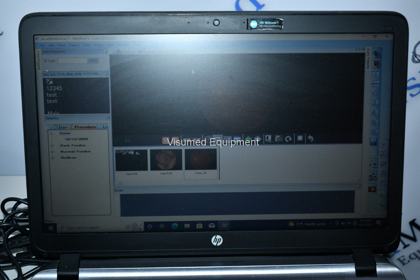 Refurbished Topcon TRC-NW8F Non-Myd Retinal Camera with Imagenet 5 Color/Red-Free/FA offered by Visumed Equipment