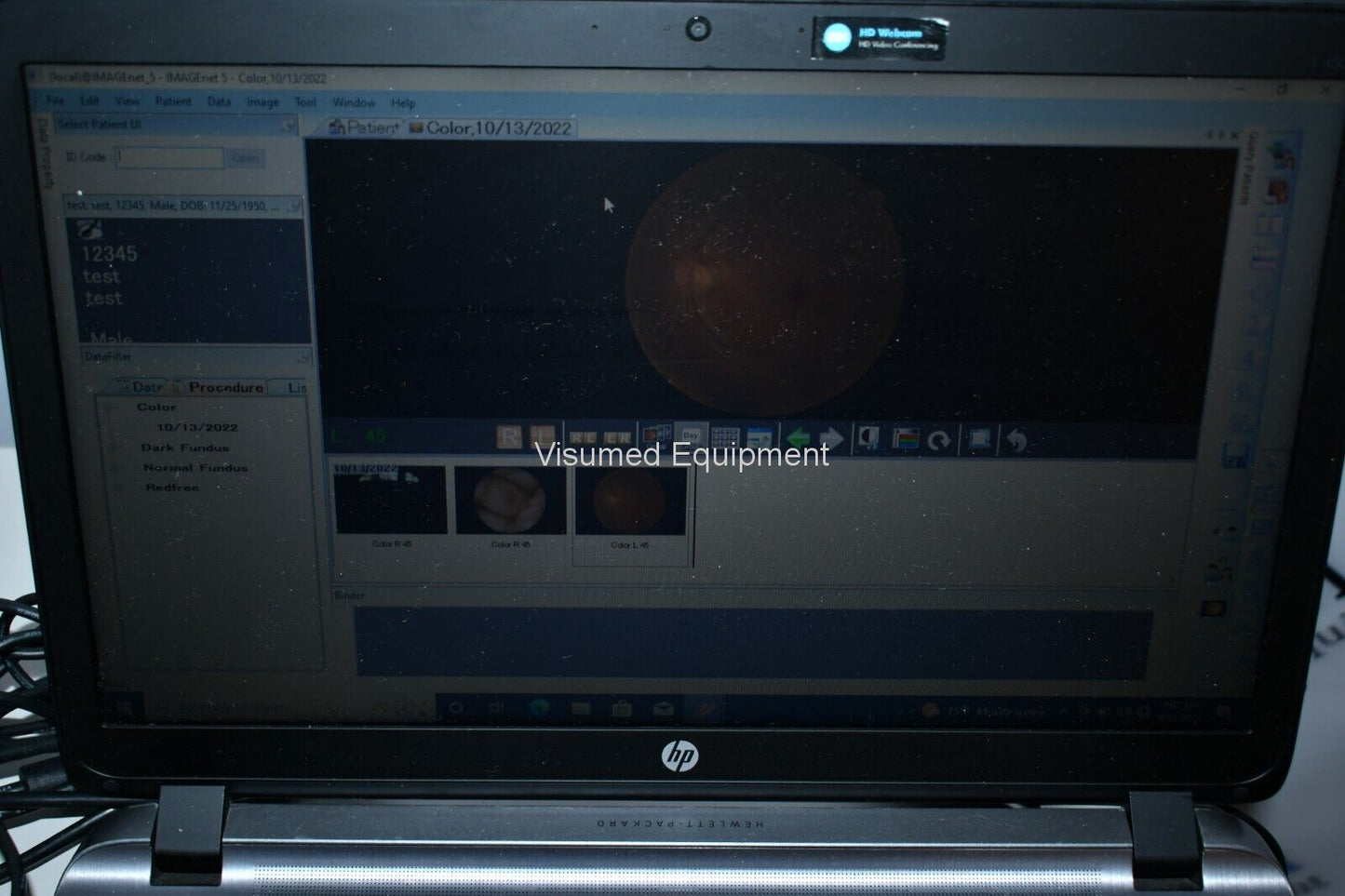 Refurbished Topcon TRC-NW8F Non-Myd Retinal Camera with Imagenet 5 Color/Red-Free/FA offered by Visumed Equipment