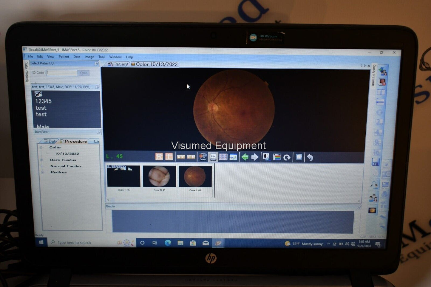Refurbished Topcon TRC-NW8F Non-Myd Retinal Camera with Imagenet 5 Color/Red-Free/FA offered by Visumed Equipment