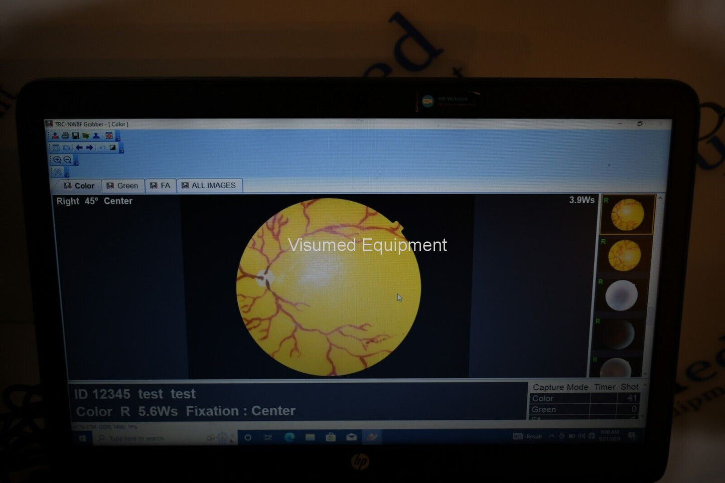 Refurbished Topcon TRC-NW8F Non-Myd Retinal Camera with Imagenet 5 Color/Red-Free/FA offered by Visumed Equipment