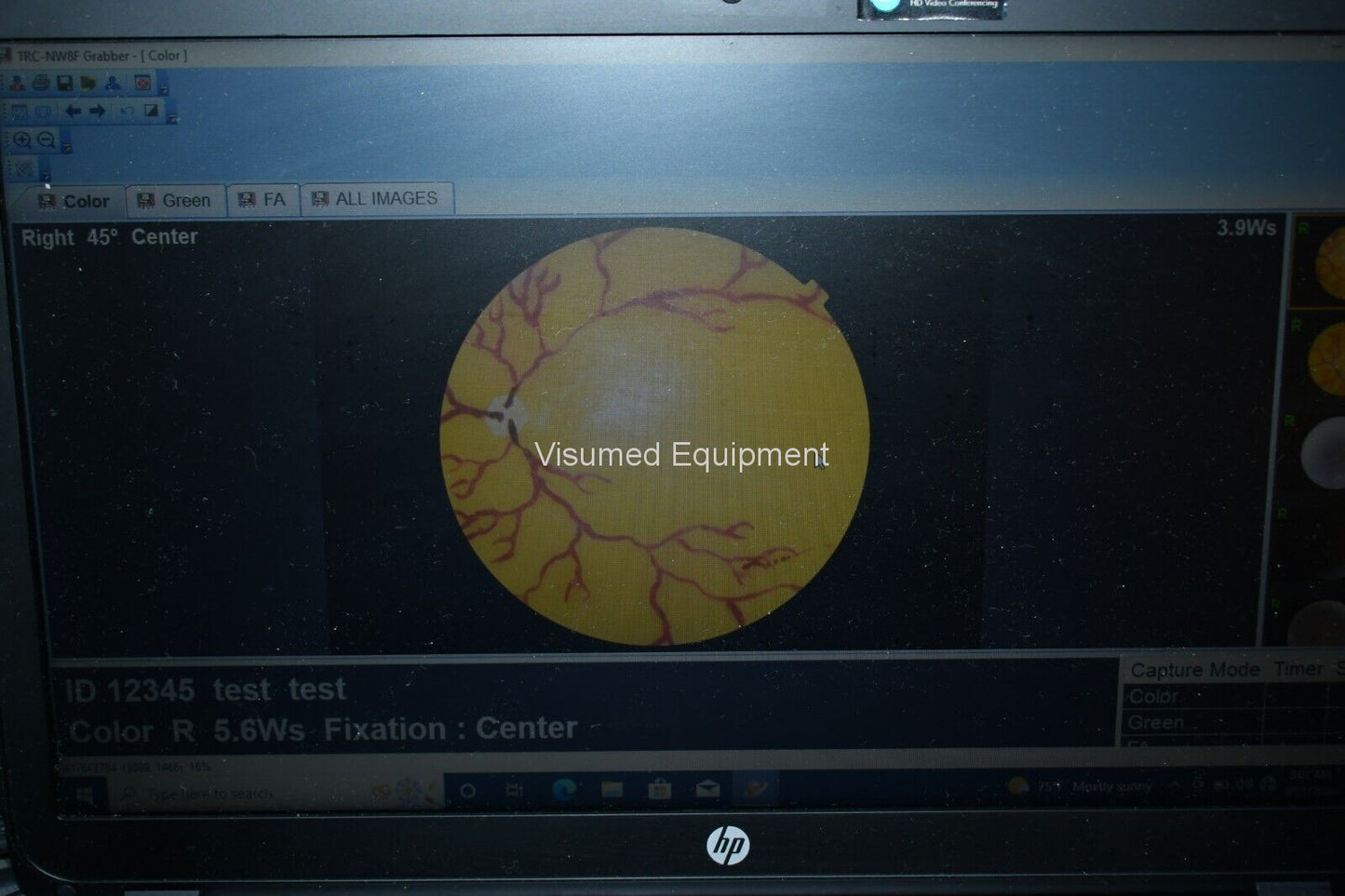 Refurbished Topcon TRC-NW8F Non-Myd Retinal Camera with Imagenet 5 Color/Red-Free/FA offered by Visumed Equipment