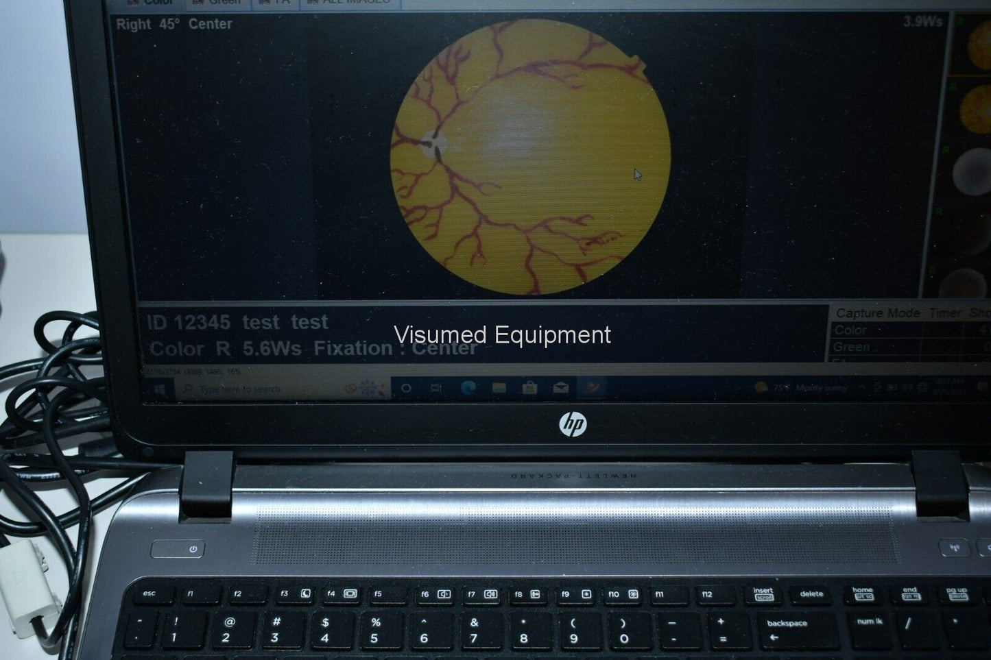 Refurbished Topcon TRC-NW8F Non-Myd Retinal Camera with Imagenet 5 Color/Red-Free/FA offered by Visumed Equipment