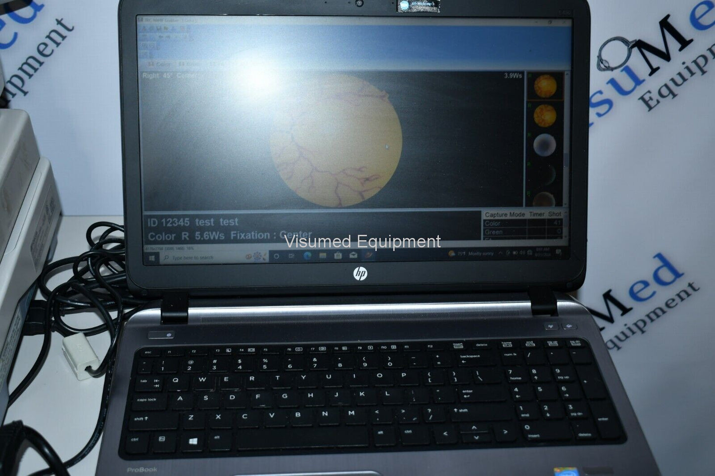 Refurbished Topcon TRC-NW8F Non-Myd Retinal Camera with Imagenet 5 Color/Red-Free/FA offered by Visumed Equipment