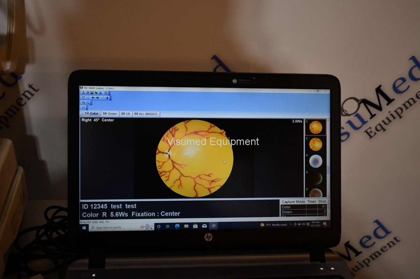 Refurbished Topcon TRC-NW8F Non-Myd Retinal Camera with Imagenet 5 Color/Red-Free/FA offered by Visumed Equipment