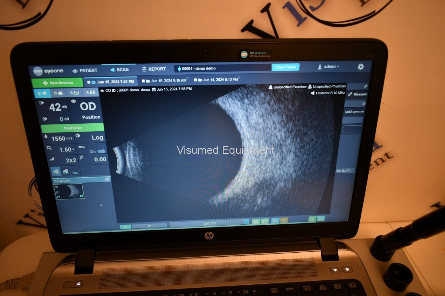Refurbished Ellex Eye One Ultrasound B-scan A-scan offered by Visumed Equipment