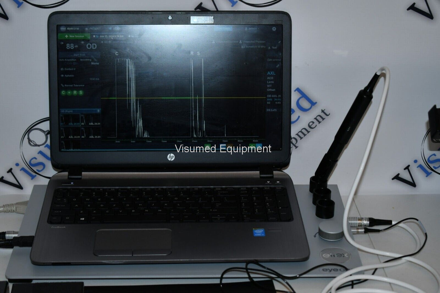 Refurbished Ellex Eye One Ultrasound B-scan A-scan offered by Visumed Equipment