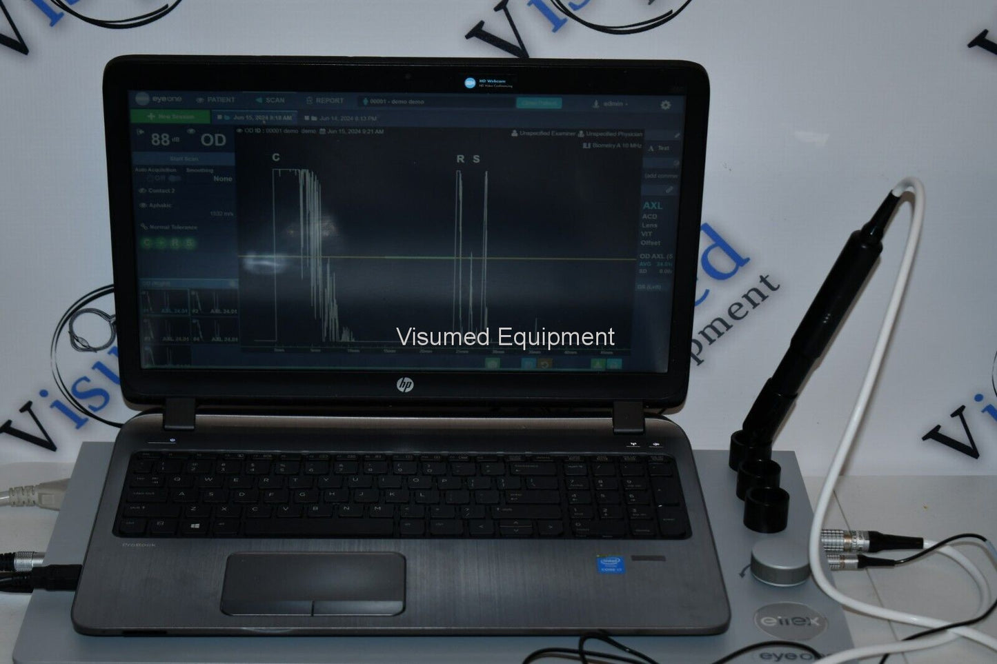 Refurbished Ellex Eye One Ultrasound B-scan A-scan offered by Visumed Equipment