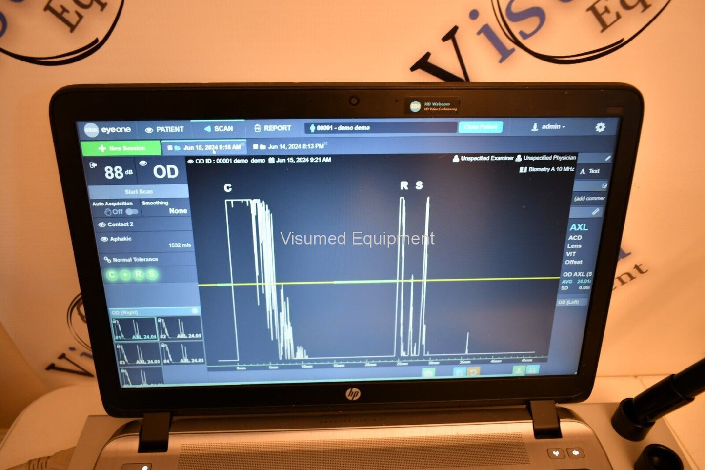 Refurbished Ellex Eye One Ultrasound B-scan A-scan offered by Visumed Equipment