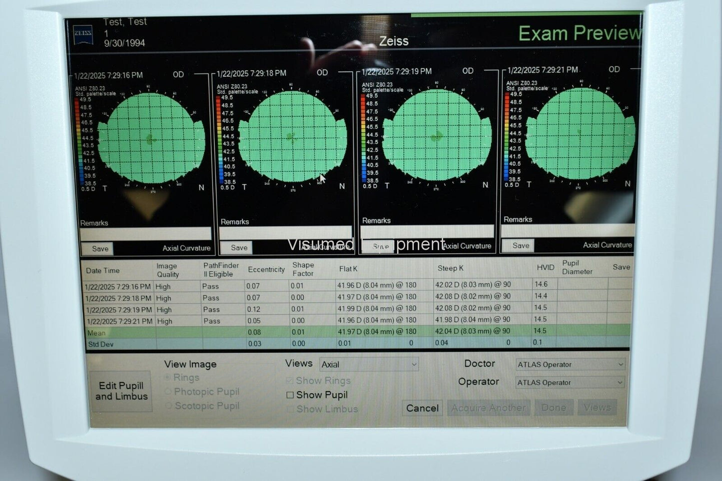 Refurbished Zeiss Atlas 9000 Corneal Topographer Windows 10 offered by Visumed Equipment