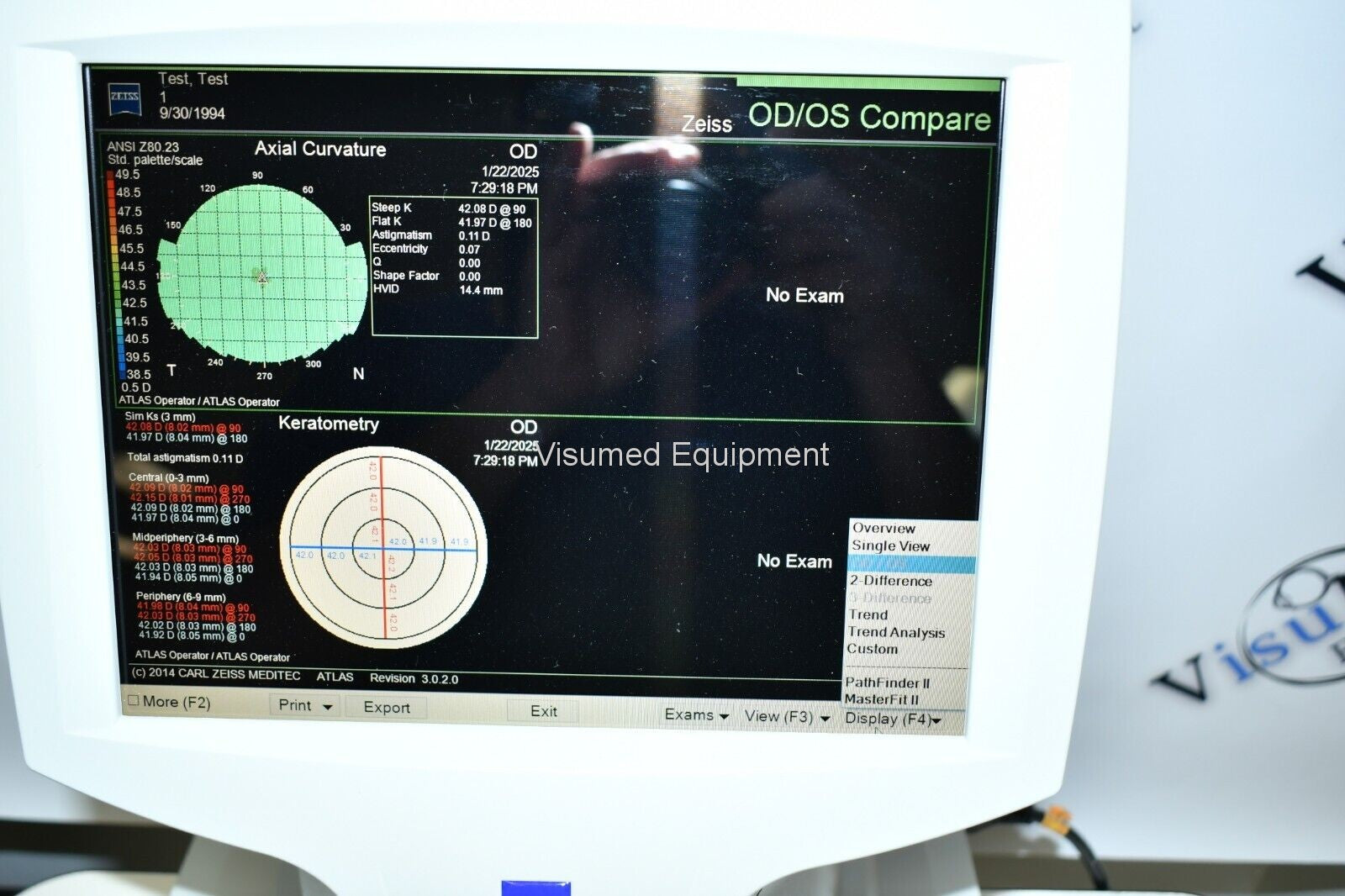Refurbished Zeiss Atlas 9000 Corneal Topographer Windows 10 offered by Visumed Equipment