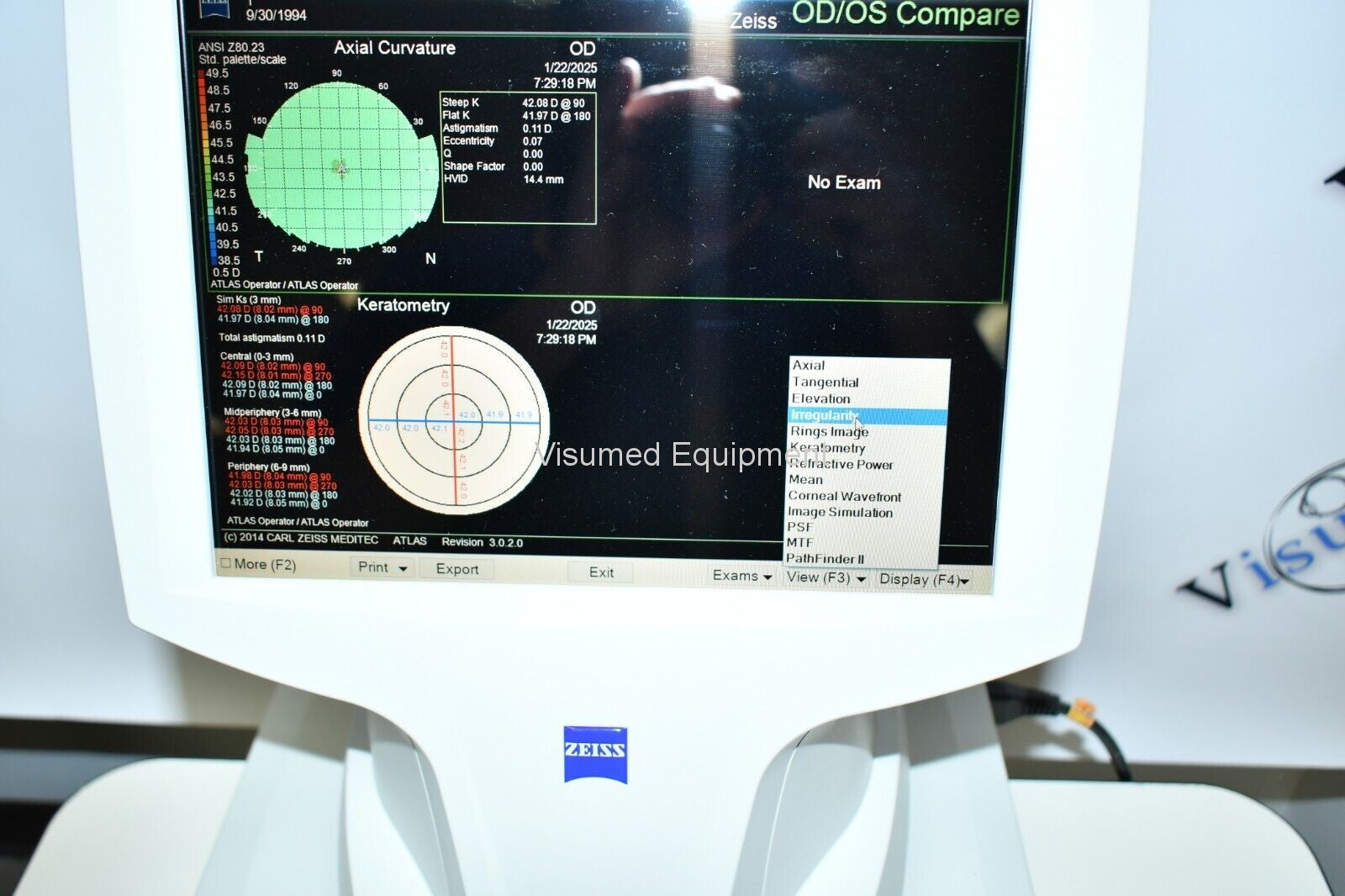 Refurbished Zeiss Atlas 9000 Corneal Topographer Windows 10 offered by Visumed Equipment