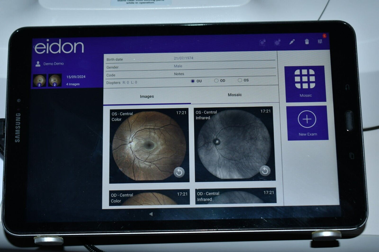 Refurbished iCare Centervue EIDON AF widefield TrueColor with Autofluorescence fundus Camera offered by Visumed Equipment