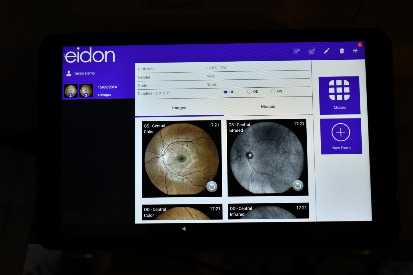 Refurbished iCare Centervue EIDON AF widefield TrueColor with Autofluorescence fundus Camera offered by Visumed Equipment