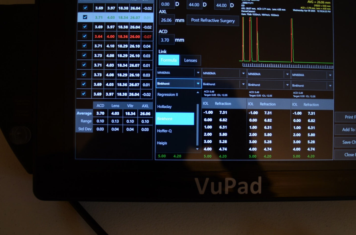 Sonomed Escalon Vupad A-scan B-scan and UBM
