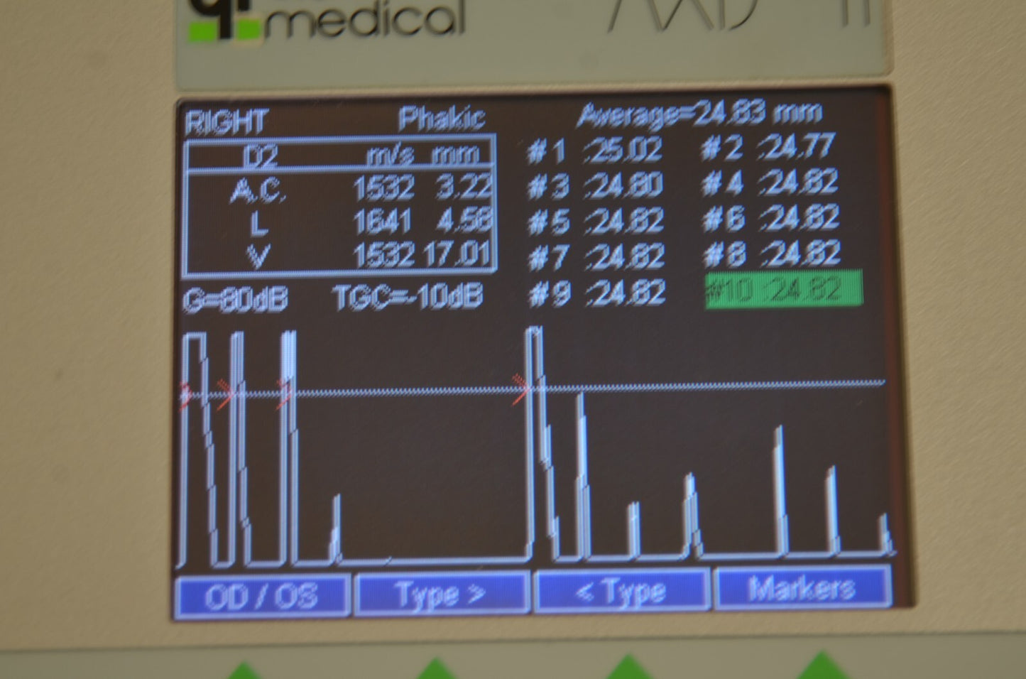 Refurbished QUANTEL MEDICAL AXIS II Ultrasound A-Scan Biometer offered by Visumed Equipment