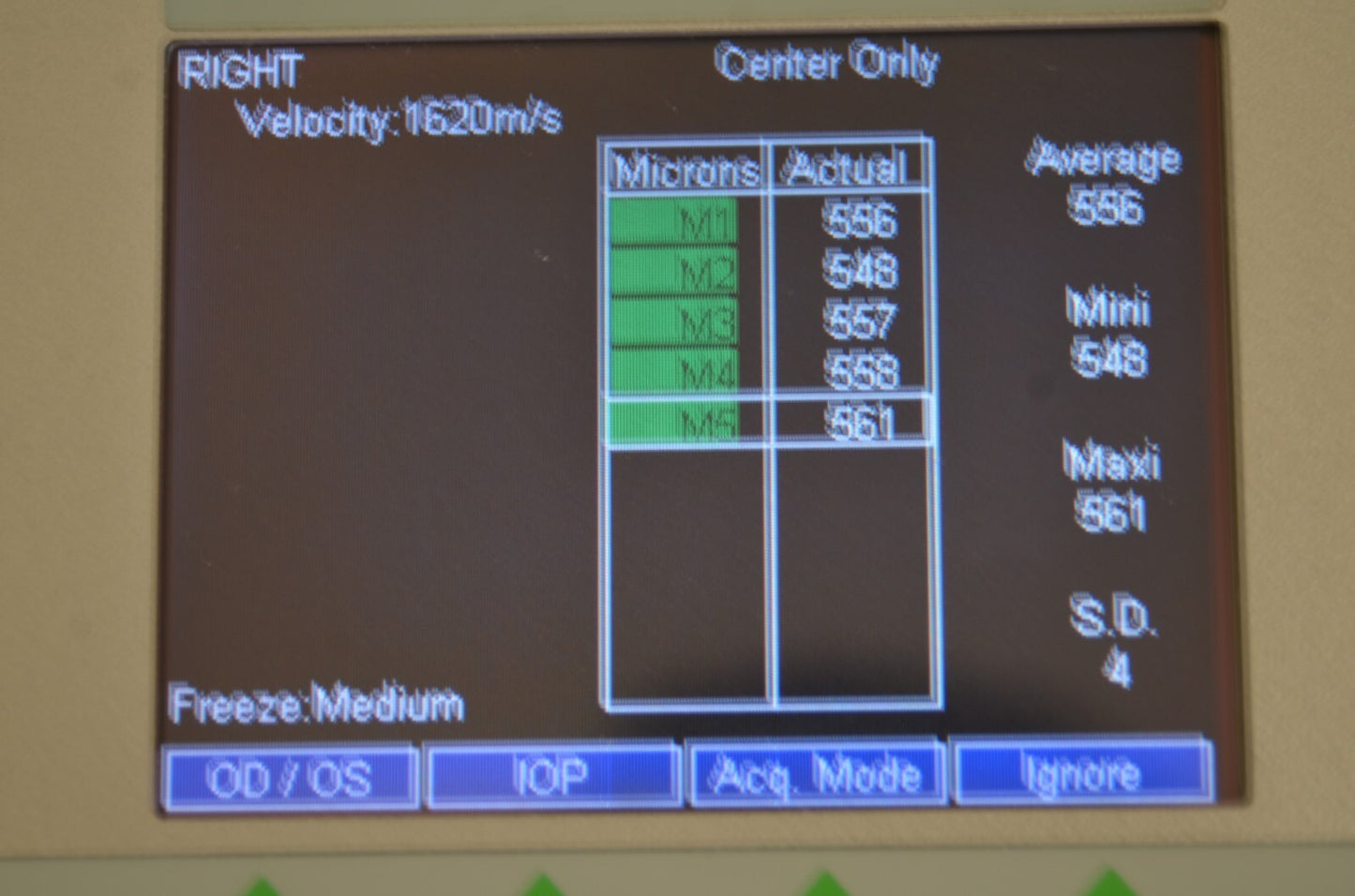 Refurbished QUANTEL MEDICAL AXIS II Ultrasound A-Scan Biometer offered by Visumed Equipment