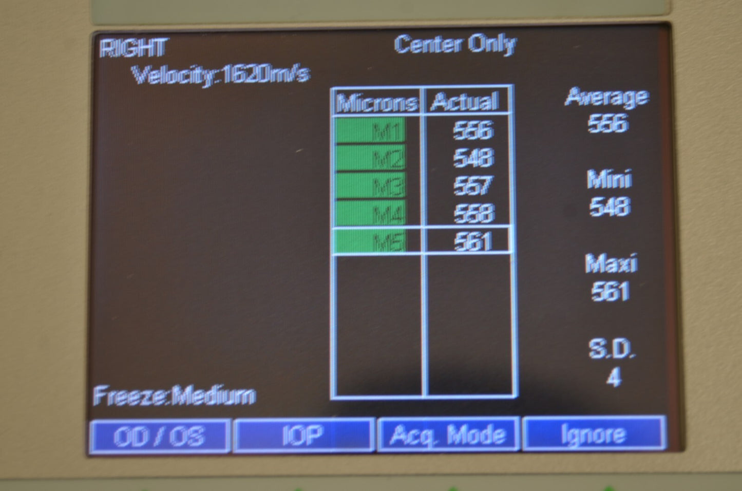 Refurbished QUANTEL MEDICAL AXIS II Ultrasound A-Scan Biometer offered by Visumed Equipment
