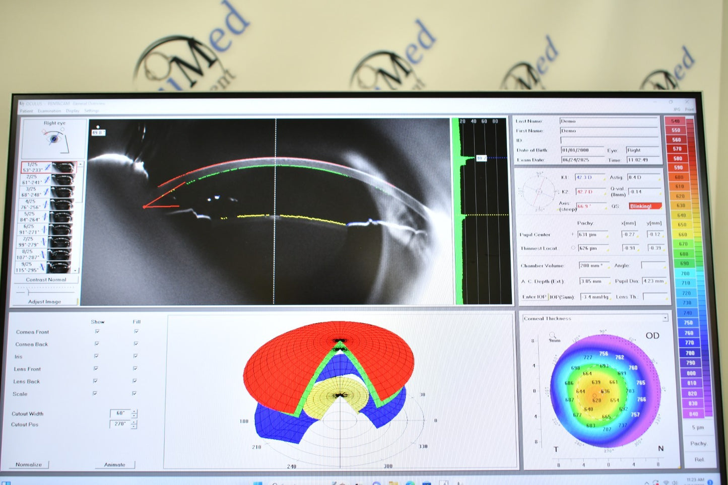Refurbished Oculus Pentacam HR Corneal Scheimpflug topographer offered by Visumed Equipment