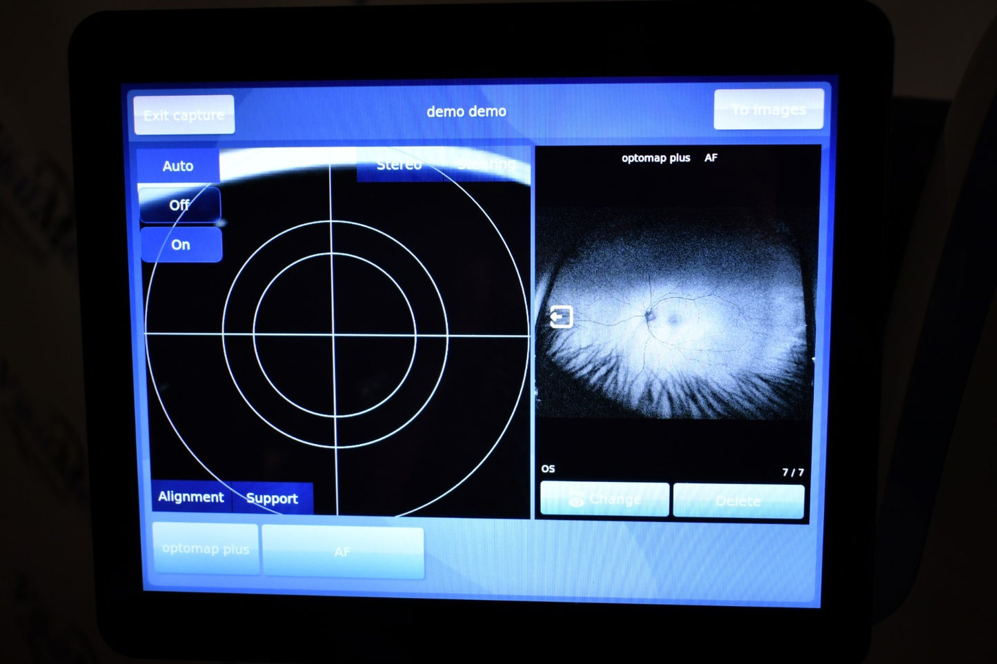 Refurbished Optos California RG AF FFA ICG retinal Camera offered by Visumed Equipment
