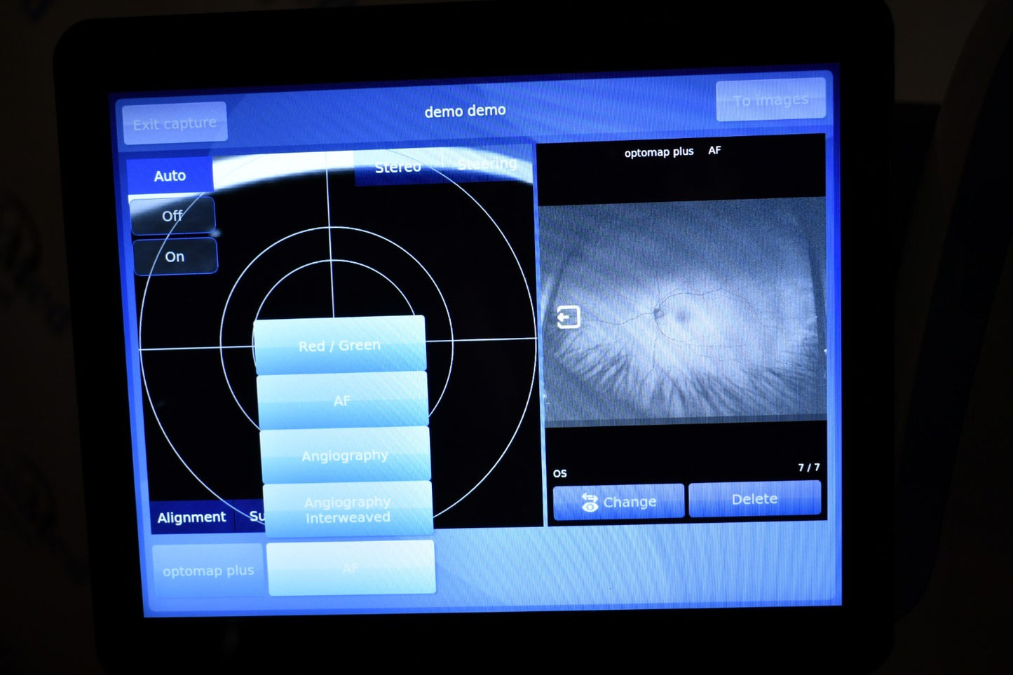 Refurbished Optos California RG AF FFA ICG retinal Camera offered by Visumed Equipment