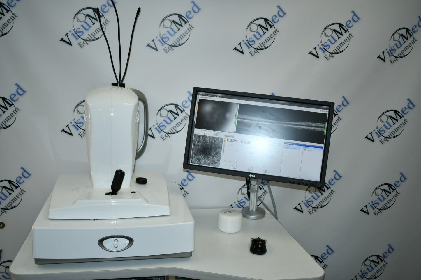 Refurbished Optovue Avanti-Angiovue OCT-A offered by Visumed Equipment