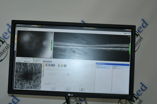 Refurbished Optovue Avanti-Angiovue Windows 10 OCT-A Angiography offered by Visumed Equipment