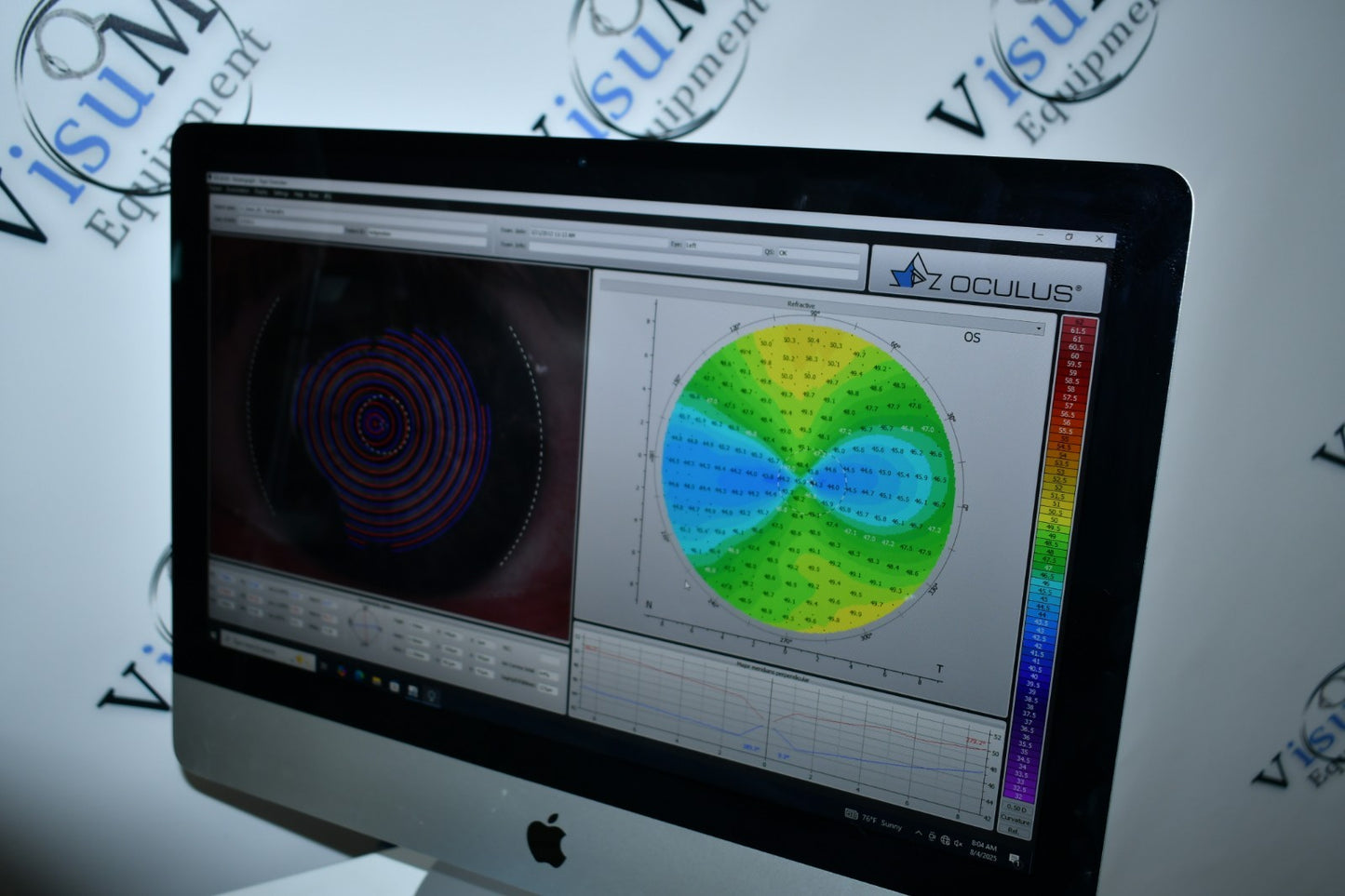 Oculus Keratograph 5M loaded with dry eye and refractive licenses