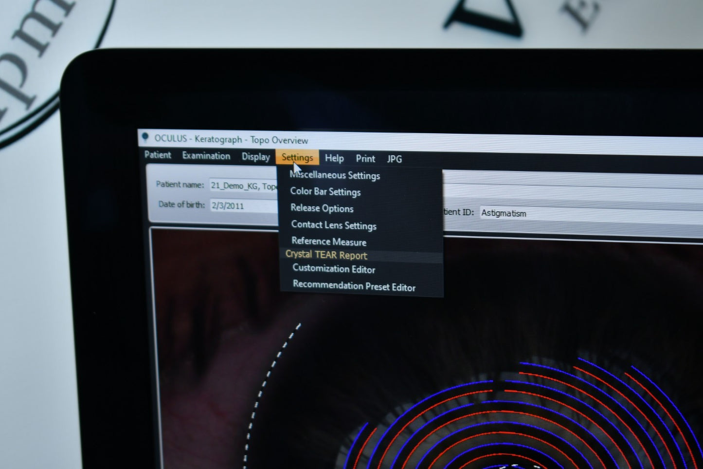 Oculus Keratograph 5M loaded with dry eye and refractive licenses